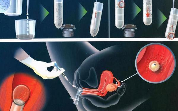 国内哪里可以做供卵试管_国内哪里可以做供卵试管？