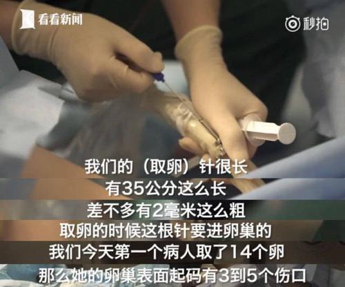 借卵子哪里有【借卵子哪里有：探寻代孕市场的真相】