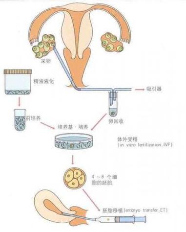 借卵试管代怀是什么-借卵试管代怀：解析背后的医学与伦理意义