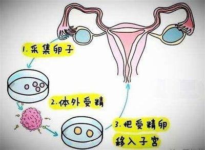 借卵生子是什么意思_借卵生子的含义是什么?